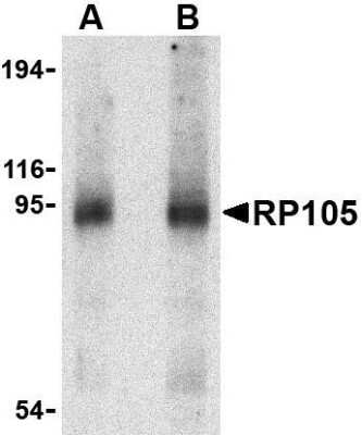 Western Blot: RP105/CD180 AntibodyBSA Free [NBP1-76707]