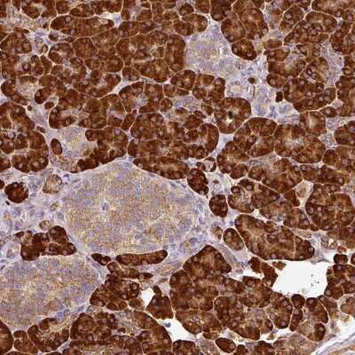 Immunohistochemistry: ANKRD18A Antibody [NBP2-48951]