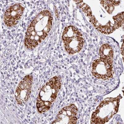 Immunohistochemistry: ANKRD18A Antibody [NBP2-48999]