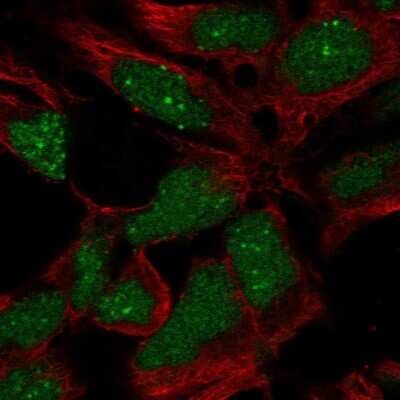 Immunocytochemistry/ Immunofluorescence: RP11-302B13.5 Antibody [NBP2-68879]