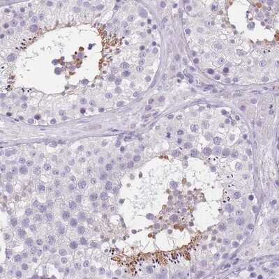 Immunohistochemistry-Paraffin: TCP11 Antibody [NBP2-14635]