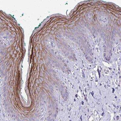 Immunohistochemistry-Paraffin: GSG1L2 Antibody [NBP2-49297]