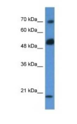 Western Blot: ARHGAP36 Antibody [NBP1-74250]