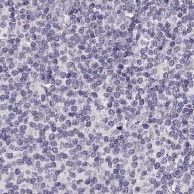 Immunohistochemistry-Paraffin: RP1L1 Antibody [NBP2-55240]