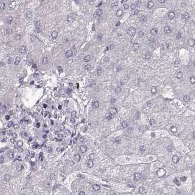 Immunohistochemistry-Paraffin: RP1L1 Antibody [NBP2-55240]