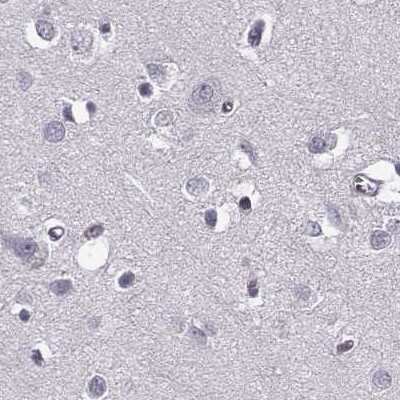 Immunohistochemistry-Paraffin: RP1L1 Antibody [NBP2-55240]