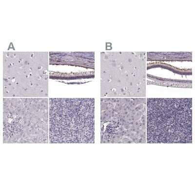 Immunohistochemistry-Paraffin: RP1L1 Antibody [NBP2-55240]