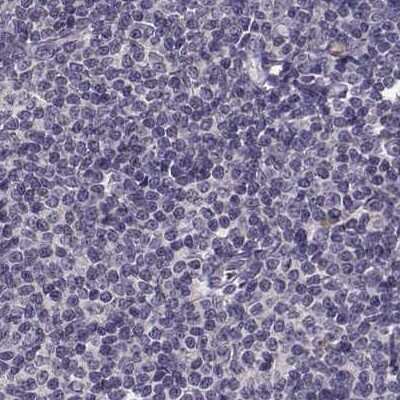 Immunohistochemistry-Paraffin: RP1L1 Antibody [NBP2-55241]