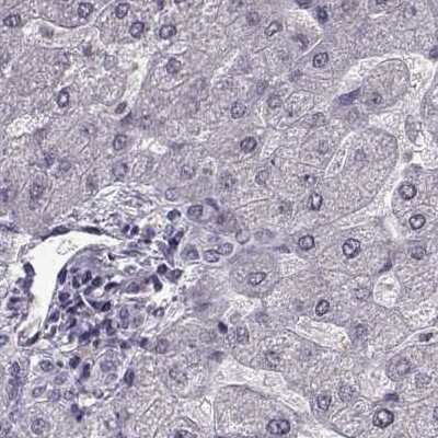 Immunohistochemistry-Paraffin: RP1L1 Antibody [NBP2-55241]