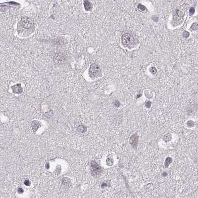 Immunohistochemistry-Paraffin: RP1L1 Antibody [NBP2-55241]