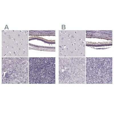 Immunohistochemistry-Paraffin: RP1L1 Antibody [NBP2-55241]