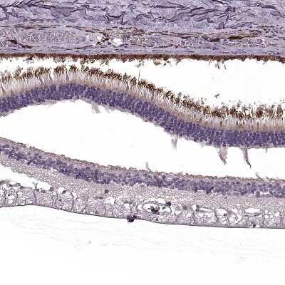 Immunohistochemistry-Paraffin: RP1L1 Antibody [NBP2-55241]