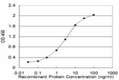 ELISA: RP2 Antibody (1B4) [H00006102-M01]