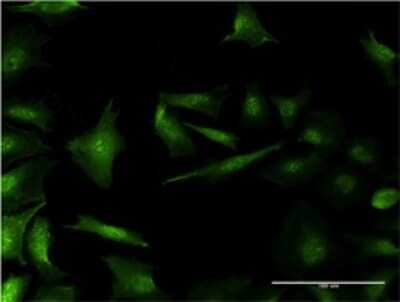 Immunocytochemistry/ Immunofluorescence: RP2 Antibody (1B4) [H00006102-M01]