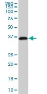 Western Blot: RP2 Antibody (1B4) [H00006102-M01]