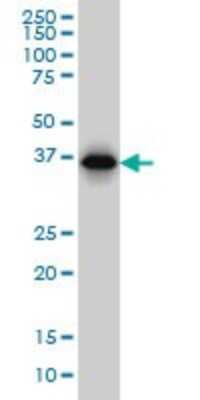 Western Blot: RP2 Antibody (5C10) [H00006102-M02]