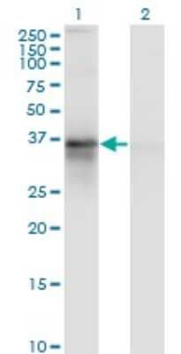 Western Blot: RP2 Antibody (5C10) [H00006102-M02]