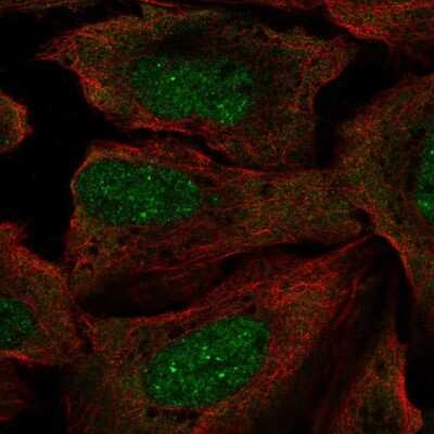 Immunocytochemistry/ Immunofluorescence: RP2 Antibody [NBP2-55193]