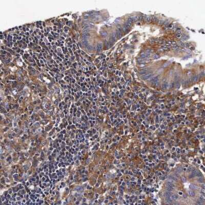 Immunohistochemistry-Paraffin: RP2 Antibody [NBP1-82549]