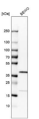 Western Blot: RP2 Antibody [NBP1-82549]