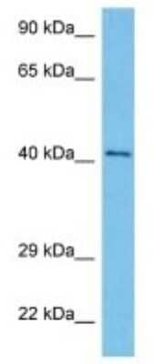 Western Blot: RP2 Antibody [NBP3-10108]