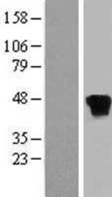 Western Blot: RP2 Overexpression Lysate [NBL1-15486]