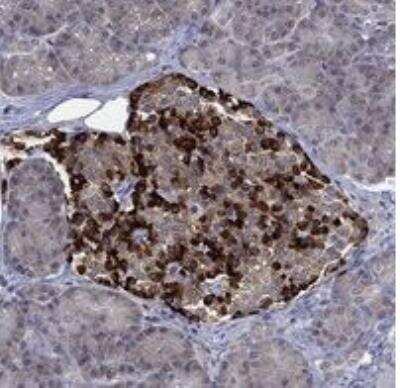 Immunohistochemistry-Paraffin: RP3-402G11.5 Antibody [NBP3-17173]