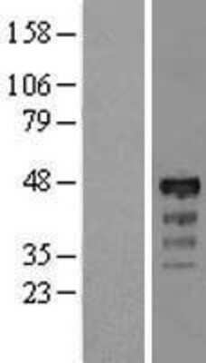 Western Blot: RP5-1077B9.4 Overexpression Lysate [NBL1-11887]