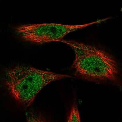 Immunocytochemistry/ Immunofluorescence: RP5-1077B9.4 Antibody [NBP1-87394]