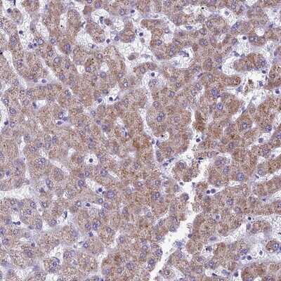 Immunohistochemistry-Paraffin: RP5-1077B9.4 Antibody [NBP1-87394]
