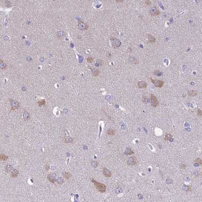 Immunohistochemistry-Paraffin: RP5-1077B9.4 Antibody [NBP1-87394]