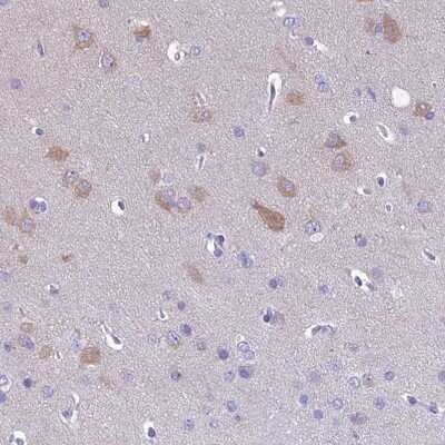 Immunohistochemistry-Paraffin: RP5-1077B9.4 Antibody [NBP1-87394]