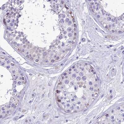 Immunohistochemistry-Paraffin: RP5-1077B9.4 Antibody [NBP1-87394]