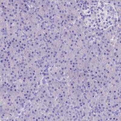 Immunohistochemistry-Paraffin: RP5-1077B9.4 Antibody [NBP1-87394]