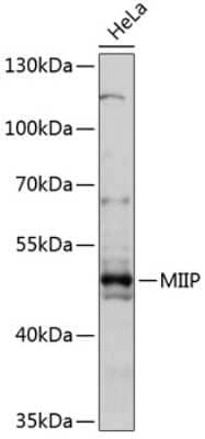 Western Blot: RP5-1077B9.4 AntibodyAzide and BSA Free [NBP3-03632]