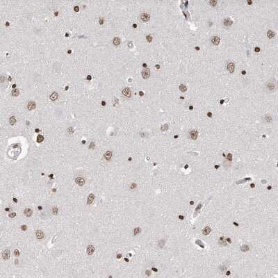Immunohistochemistry-Paraffin: RP9 Antibody [NBP1-87342]