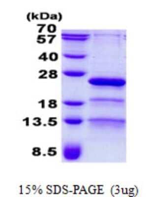 SDS-PAGE: Recombinant Human RP9 His Protein [NBP2-23409]