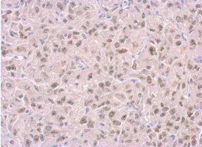 Immunohistochemistry-Paraffin: RPA14 Antibody (11.1) [NB100-159]