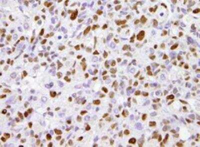 Immunohistochemistry-Paraffin: RPA14 Antibody (11.1) [NB100-159]