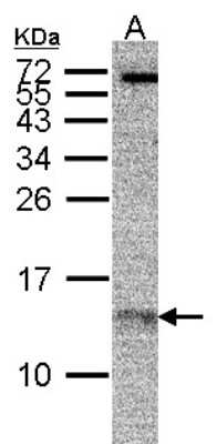 Western Blot: RPA14 Antibody (11.1) [NB100-159]