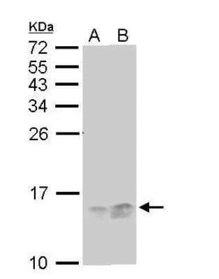 Western Blot: RPA14 Antibody (11.1) [NB100-159]