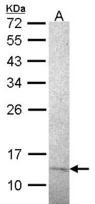 Western Blot: RPA14 Antibody (14.2) [NB100-160]