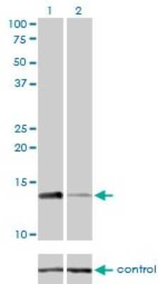 Western Blot: RPA14 Antibody (1F4) [H00006119-M01]