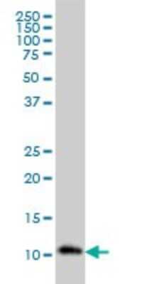 Western Blot: RPA14 Antibody (1F4) [H00006119-M01]