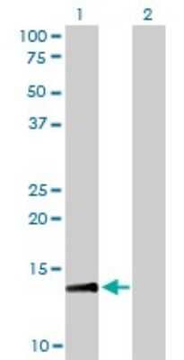 Western Blot: RPA14 Antibody (1F4) [H00006119-M01]