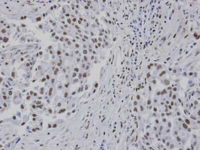 Immunohistochemistry-Paraffin: RPA14 Antibody [NBP1-32023]