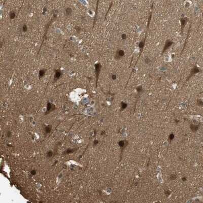 Immunohistochemistry-Paraffin: RPA14 Antibody [NBP1-87141]