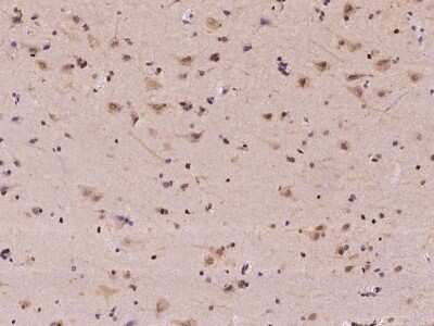 Immunohistochemistry-Paraffin: RPA14 Antibody [NBP2-97782]