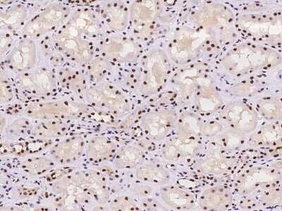 Immunohistochemistry-Paraffin: RPA14 Antibody [NBP2-97782]