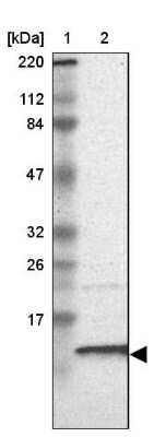 Western Blot: RPA14 Antibody [NBP1-87141]